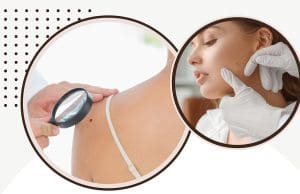 Prijavite se za besplatne preglede i edukaciju za rano otkrivanje melanoma